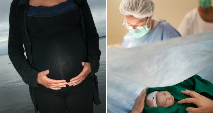 Kvinna, Kejsarsnitt, Födsel, Italien, Gravid